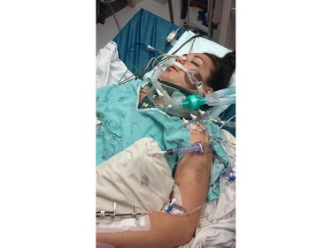 Stephanie Albert, 29, suffered grievous injuries when she was struck, head on, by a drunk driver on Sept. 1, 2017. She documented her injuries in a graphic blog that went viral. Photo from her blog.