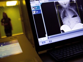 A radiology technician looks at a chest X-ray of a child suffering from flu symptoms. Patients often wait hours in the ER, and there is little the medical staff can do about it.