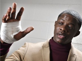 James Shaw Jr., shows his hand that was injured when he disarmed a shooter inside a Waffle House on Sunday, April 22, 2018, in Nashville, Tenn.   A gunman stormed the Waffle House restaurant and shot several people to death before dawn, according to police, who credited Shaw, a customer with saving lives by wresting the assailant's weapon away.