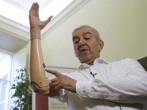 Marco Zambelli shows his prosthetic hand during an interview with the Associated Press in Rome Thursday, May 10, 2018. An Italian government-funded research institute and prosthetic maker unveiled a new robotic hand that they say amputees to grip objects with more precision, and with a mechanical design that will significantly bring down the price of a myoeletric prosthetic hand.
