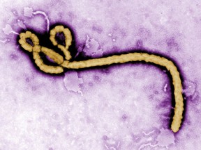 In this undated colorized transmission electron micrograph file image made available by the CDC shows an Ebola virus virion.