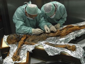 In this November 2010 photo provided by the South Tyrol Museum of Archaeology, researchers examine the body of a frozen hunter known as Oetzi the Iceman to sample his stomach contents in Bolzano, Italy. In a report released on Thursday, July 12, 2018, scientists said the analysis offers a snapshot of what ancient Europeans ate more than five millennia ago.