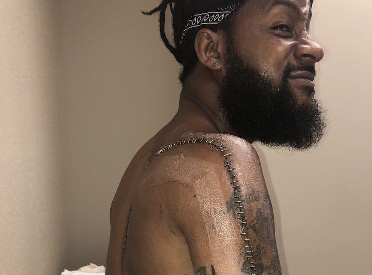 ExCFLer Jonathan Hefney takes another step in recovery from injury