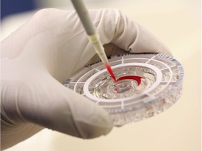 FILE - A blood sample being tested.
