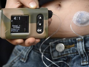 Insulin pump