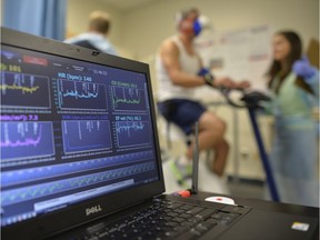 FILE - In this Aug. 27, 2014 file photo, a laptop computer monitors a patient's heart function as he takes a stress test while riding a stationary bike.