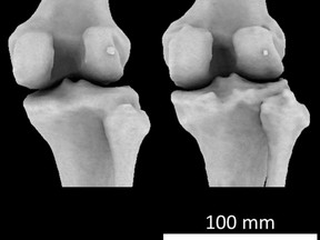 The white dot on the right of the larger bones is the fabella, which is becoming increasingly common in humans.