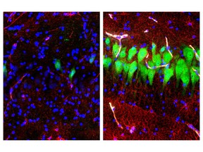 This combination of images provided by the Yale School of Medicine in April 2019 shows stained microscope photos of neurons, green; astrocytes, red, and cell nuclei, blue, from a pig brain left untreated for 10 hours after death, left, and another with a specially designed blood substitute pumped through it. By medical standards "this is not a living brain," said Nenad Sestan of the Yale School of Medicine, one of the researchers reporting the results Wednesday, April 17, 2019, in the journal Nature. But the work revealed a surprising degree of resilience within a brain that has lost its supply of blood and oxygen, he said.