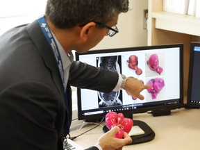Dr. Sony Singh holds 3D-printed uterus and looks at images of it on computer screens.