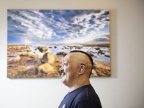 Joellie Qaunaq from Arctic Bay, Nunavut, had 52 stitches after having a glioblastoma tumour removed in a seven-hour surgery. Glioblastoma is said to be the “cancer that always comes back.” The operation and treatment attempted to keep the cancer at bay and extend his life.