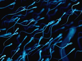 Medically accurate illustration of human sperm.