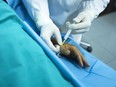 A doctor a private U.S. clinic injects a patient with stem cells to treat cartilage wastage joint injury and pain.