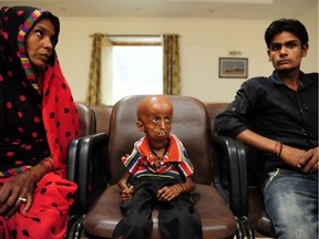 Young Indian progeria sufferer Rupesh (C) sits with his mother Shanti Devi (L) and younger brother Vakil (R) at Allahabad District Magistrates Office in Allahabad on May 2, 2017, as they seek government financial support for his treatment. 21 year old Rupesh who comes from a village on the outskirts of Allahabad suffers from progeria disease, also known as Hutchinson-Gilford progeria syndrome (HGPS), which causes premature aging as a result of a genetic condition it affects some 1 in every 4 million births across the world.