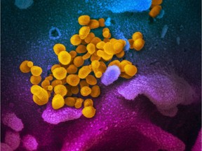 TOPSHOT - This handout illustration image obtained February 27, 2020 courtesy of the National Institutes of Health taken with a scanning electron microscope  shows SARS-CoV-2 (yellow)also known as 2019-nCoV, the virus that causes COVID-19.