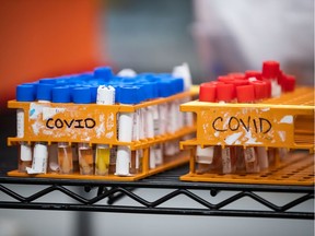 Specimens to be tested for COVID-19.