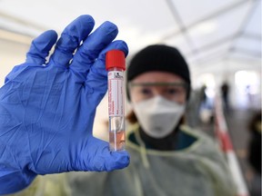 A medical employee presents a smear taken at a special coronavirus test centre in Munich.
