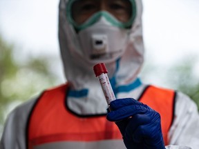 A doctor holds a container used to collect a sample from a patient during a demonstration of a drive-through polymerase chain reaction (PCR) swab test for the COVID-19 coronavirus in Fujisawa in Kanagawa prefecture, southwest of Tokyo, on April 27, 2020.