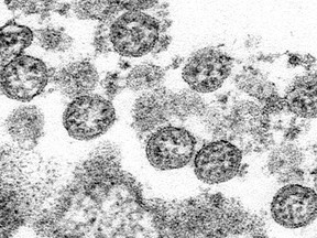 This 2020 electron microscope made available by the U.S. Centers for Disease Control and Prevention image shows the spherical coronavirus particles from the first U.S. case of COVID-19. The Canadian Paediatric Society is closely monitoring reports of an inflammatory syndrome among some kids also diagnosed with COVID-19.THE CANADIAN PRESS/AP-C.S. Goldsmith, A. Tamin/ CDC via AP