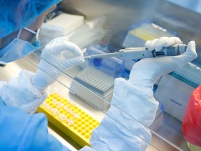 FILE PHOTO: A scientist prepares samples during the research and development of a vaccine against the coronavirus disease (COVID-19).