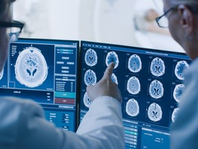 FILE: Doctors looking at brain scans.