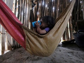 Yesmin Anayeli Perez, a 22-months-old girl diagnosed with severe malnutrition, drinks Incaparina, a protein vegetable food handed out by the government, at her home, in La Ceiba, Guatemala October 9, 2020.