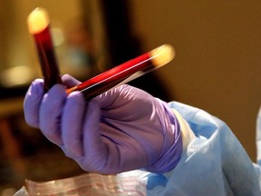 A phlebotomist processes the blood specimens of people getting tested for coronavirus antibodies at the Refuah Health Center on April 24, 2020 in Spring Valley, New York.