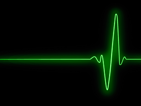 "With the heart being an organ that is strong and robust, the idea that it pauses before finally stopping is actually quite reasonable, physiologically."