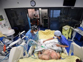 Medical staff tend to a patient at the intensive care unit for patients infected with the Covid-19 (novel coronavirus) at the AP-HP Tenon hospital on January 26, 2021 in Paris.