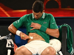 Novak Djokovic of Serbia rubs cream into his side in his Men's Singles third round match against Taylor Fritz of the United Statesduring day five of the 2021 Australian Open at Melbourne Park on February 12, 2021 in Melbourne, Australia.