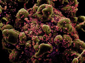 FILE PHOTO: Colourized scanning electron micrograph of an apoptotic cell (greenish brown) heavily infected with SARS-COV-2 virus particles (pink), also known as novel coronavirus, isolated from a patient sample. Image captured and colour-enhanced at the NIAID Integrated Research Facility (IRF) in Fort Detrick, Maryland.