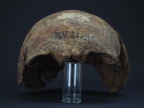 Partial skull of the hunter-gatherer who died 4,000 years before the emergence of the Black Death.