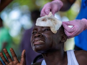 A boy injured after Saturday's 7.2 magnitude quake cries while being treated at the Ofatma Hospital, in Les Cayes, Haiti August 18, 2021.