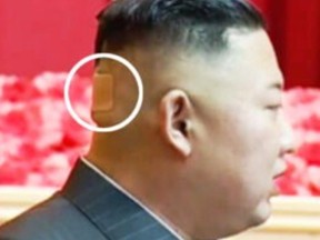 Kim Jong Un is pictured with a large bandaid on the back of his head.