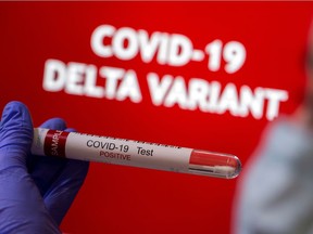 FILE PHOTO: A person holds a test tube labelled 'COVID-19 Test Positive' in front of displayed words 'COVID-19 Delta variant' in this illustration.