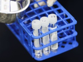 A medical worker carries RT-PCR swab tests at a pre-departure coronavirus disease (COVID-19) testing facility, as countries react to the new coronavirus Omicron variant, outside the international terminal at Sydney Airport in Sydney, Australia, November 29, 2021.