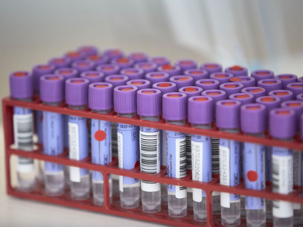 COVID19 Six deaths in Ottawa over the past week Ottawa Citizen