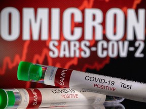 FILE PHOTO: Test tubes labelled