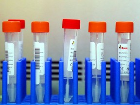 Patient swabs await testing for COVID-19.