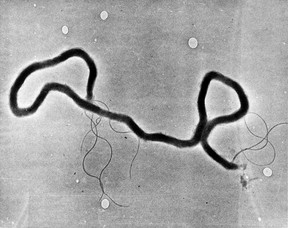 This is the least abhorrent image of syphilis that we could find. Unfortunately, the centuries-old sexually transmitted disease is having a bit of a revival across Canada right now. Click here to learn more.