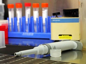 File photo: A pipette used for testing samples (background) for COVID-19 rests on a workstation  in the medical microbiology laboratory of Belleville General Hospital