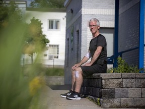 Bruce McConville says he and another man were bitten by a pitbull Saturday night during a senior's dance at the Centre Pauline-Charron in Vanier.