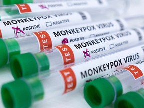 FILE PHOTO: Test tubes labelled "monkeypox virus positive and negative" are seen in this illustration taken May 23, 2022.