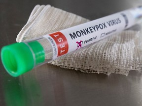 A test tube labelled "Monkeypox virus positive" is seen in this illustration taken in May.
