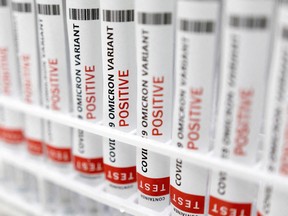FILE PHOTO: Test tubes labelled