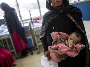 An Afghan woman holds her 5-month-old daughter at the malnutrition ward of the Indira Gandhi Children Hospital, in Kabul, Afghanistan.