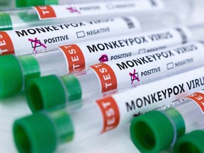 FILE PHOTO: Test tubes labeled "Monkeypox virus positive and negative" are seen in this illustration taken May 23, 2022.