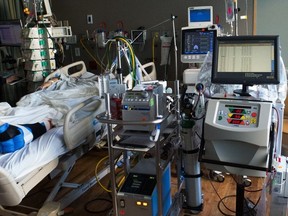 The ECMO machine temporarily replaces the heart and lungs of patients suffering from heart or respiratory failure and is being used at five centres in Ontario, including the University of Ottawa Heart Institute.