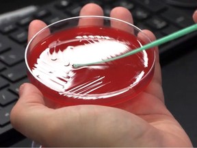 Testing blood sample with Long Covid