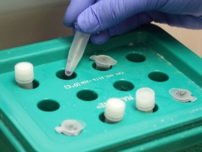 A technologist handles samples for COVID-19 testing.