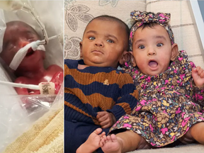 Adiah and Adrial were born 126 days early.